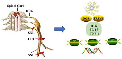 DNA Methylation: A Target in Neuropathic Pain